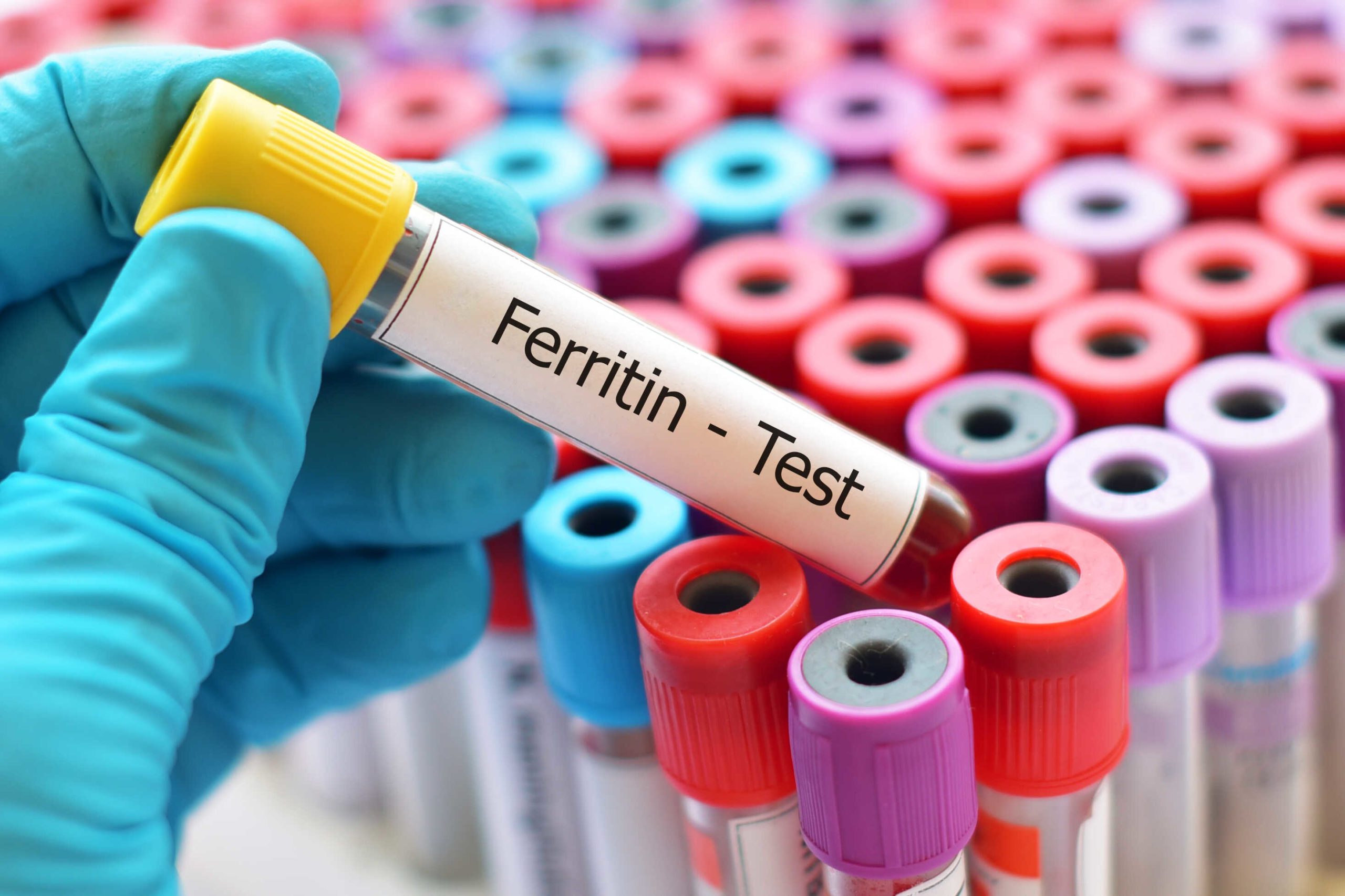 מה זה Ferritin ערכים פריטין נמוך מה זה אומר goodmed רפואה ובריאות